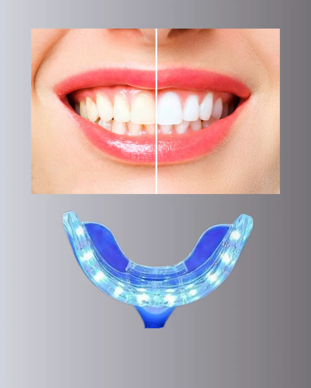 Mavi Işık Teknolojisi ile Güvenli Diş Beyazlatıcı Sistem